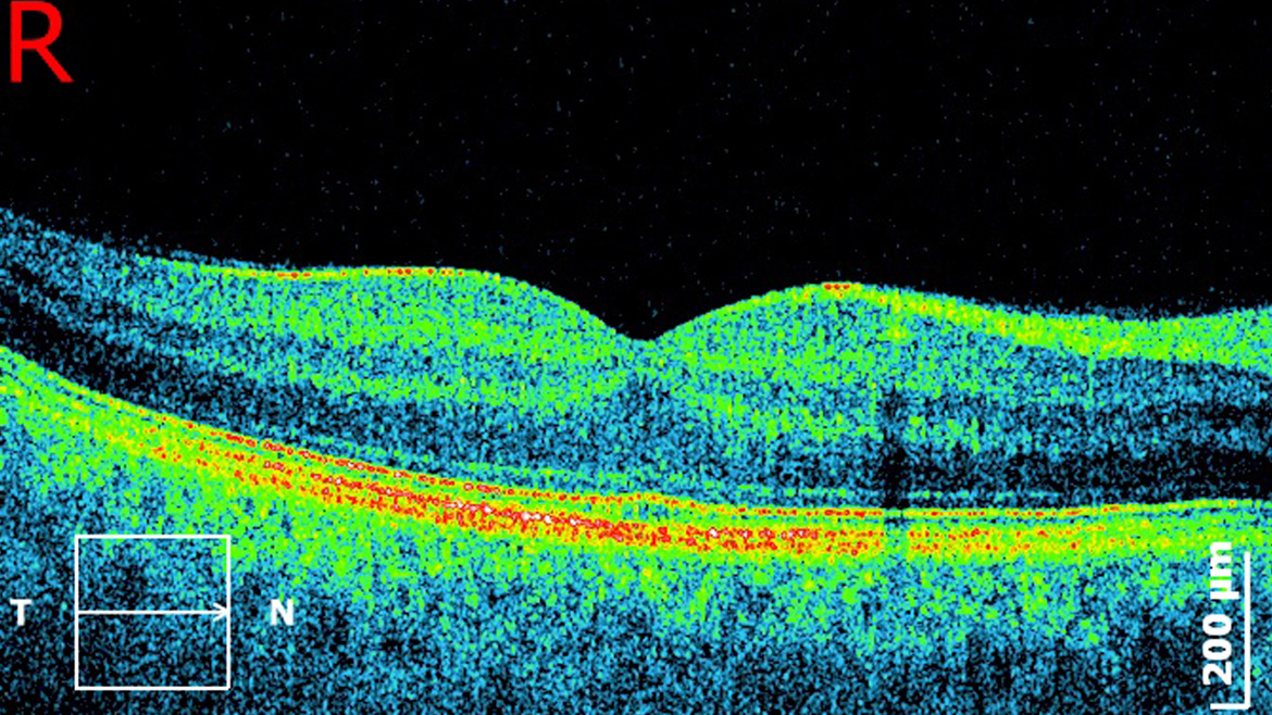 Innovations in Optical Coherence Tomography