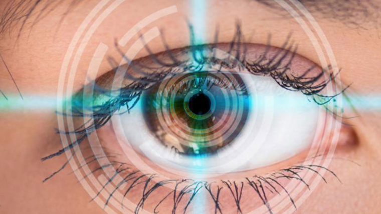 Иридотомия – Лазерное лечение глаукомы