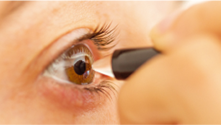 The importance of measuring the thickness of the cornea: pachymetry